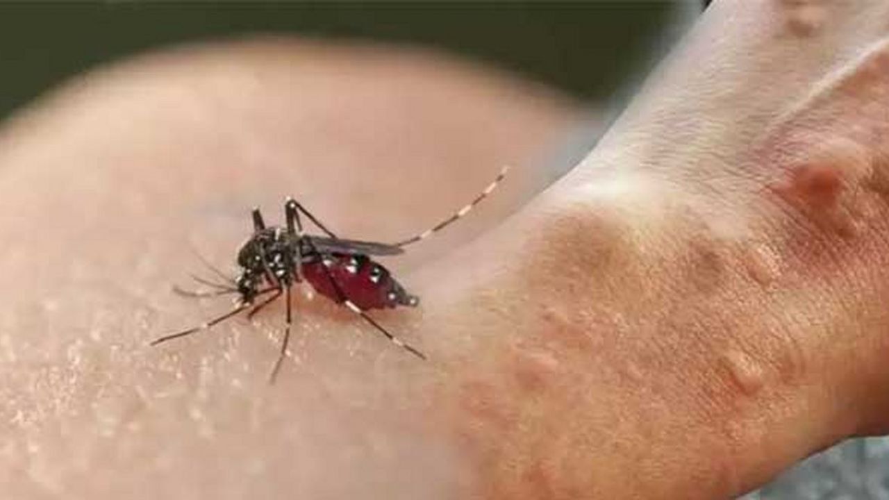 Sivrisinek ısırığına doğal önlemler