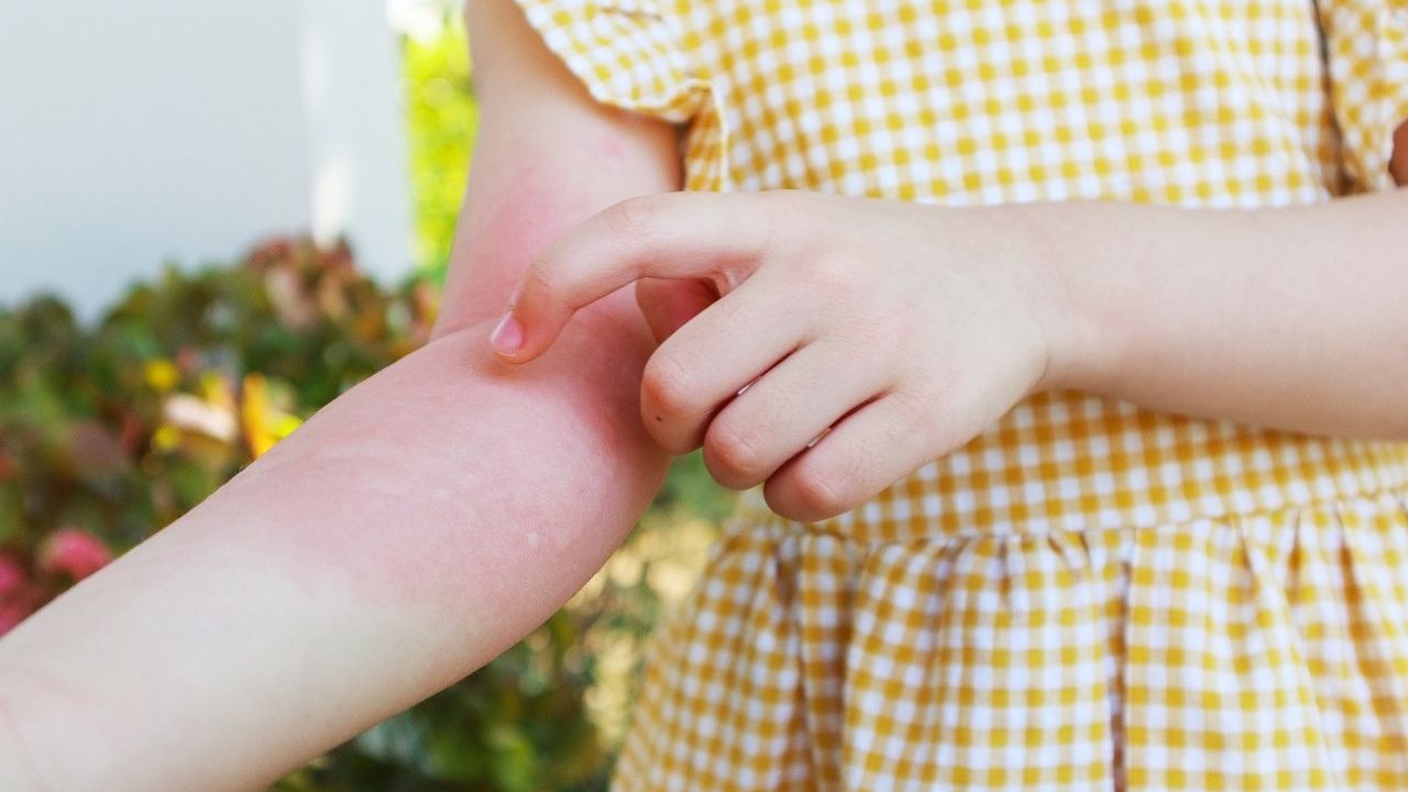 Çocuklarda ‘alerjik hastalıklar’ hakkında doğru sanılan 8 hatalı bilgi!