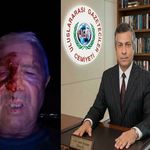 Karamürsel'de Gazeteciye Şiddet Skandalı!
