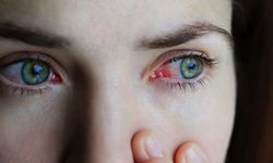 Endişeye Yol Açan Kırmızı Göz Hastalığı Nedir, Belirtileri Nelerdir?