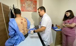 Hacamat ve sülük uygulamaları resmileştirildi!