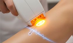 Ev Tipi IPL Cihazları Güvenli mi, Herkes Kullanabilir mi?