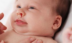 Çocuklarda Burun Kanaması Her Zaman Masum Değil!