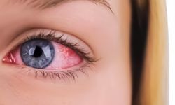 Sinsi Tehlike: Göz Tansiyonu Görme Kaybına Yol Açabiliyor