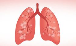 Zatürre Ölüme Götürebiliyor: Aşılama ile Önlenebilir!