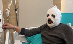 Erzincan’da Kalorifer Kazanında Dehşet: Benzin Döktü, Alevler Arasında Kaldı (VİDEO)