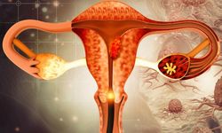 Sessiz Tehlike, Güçlü Önlem: Serviks Kanseri Bir Testle Durdurulabiliyor