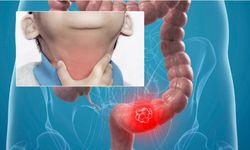 Difteri Toksini Kolon Kanserini Nasıl Durdurdu?