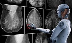 Yapay Zekâ Meme Kanserini İnsanlardan Daha Hızlı Yakalayabilir mi?