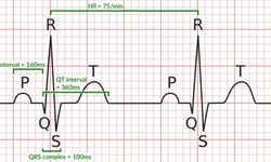 Kalbin Sessiz Çığlığı: EKG'deki Küçük Değişimler Büyük Bir Felaketi Önleyebilir mi?