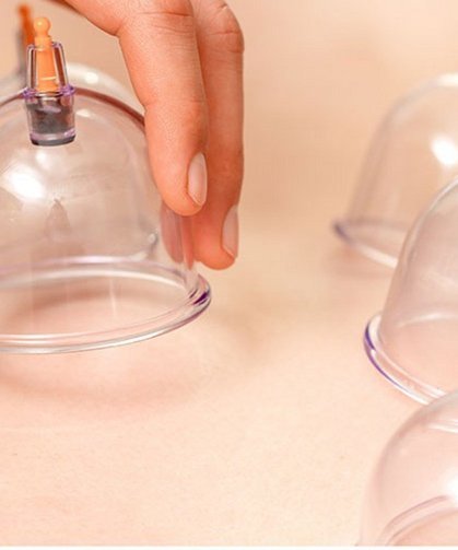 Nisan ayında şifa kapıda: İşte 2026 hacamat takvimi