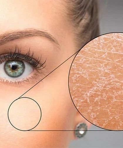 Kışın Artan Cilt Kuruluğuna Dikkat: Uzmanlar Altta Yatan Nedenlere İşaret Ediyor