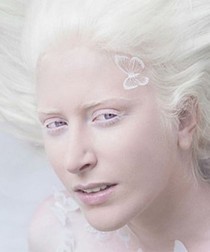 Albinizmde Görme Neden Zayıf?