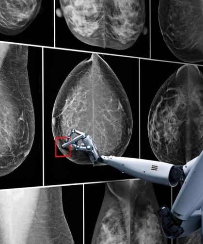 Yapay Zekâ Meme Kanserini İnsanlardan Daha Hızlı Yakalayabilir mi?