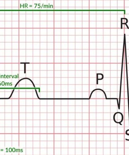 Kalbin Sessiz Çığlığı: EKG'deki Küçük Değişimler Büyük Bir Felaketi Önleyebilir mi?