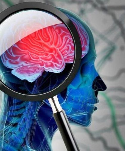 Yaşam Süresini Belirleyen Fark Bulundu! Alzheimer mı Lewy Cisimcikli Demans mı?