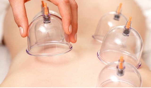 Nisan ayında şifa kapıda: İşte 2026 hacamat takvimi