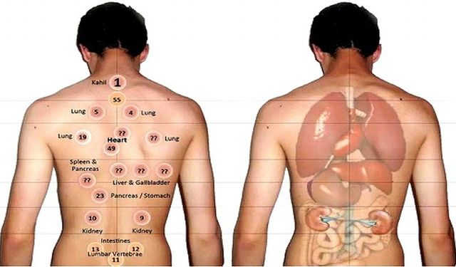 Hacamat Nedir? Faydaları, Nasıl ve Hangi Gün Yapılır?