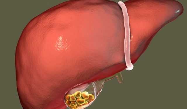 Safra Kesesi Sorunları: Erken Belirtiler Hayat Kurtarır