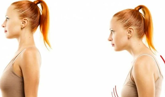 Dik Duruş Korsesi ile Omurganıza Destek Verin