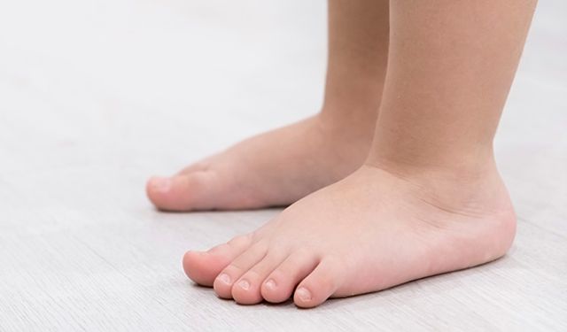 Çocuklarda Düztabanlık: Erken Tanı ve Belirtilere Dikkat Edilmeli
