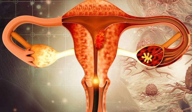 Sessiz Tehlike, Güçlü Önlem: Serviks Kanseri Bir Testle Durdurulabiliyor