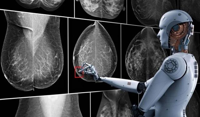 Yapay Zekâ Meme Kanserini İnsanlardan Daha Hızlı Yakalayabilir mi?