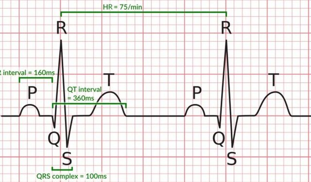 Kalbin Sessiz Çığlığı: EKG'deki Küçük Değişimler Büyük Bir Felaketi Önleyebilir mi?