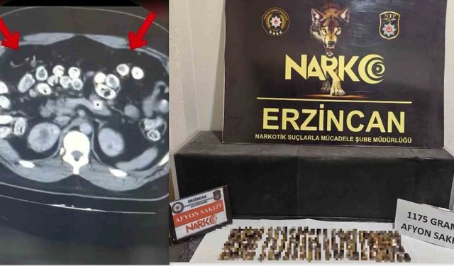 Erzincan