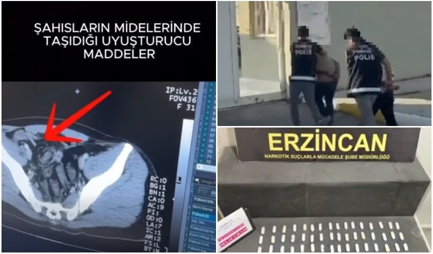 Pes Dedirten Yöntem! Uyuşturucuyu Midelerinde Taşıdılar (VİDEO)
