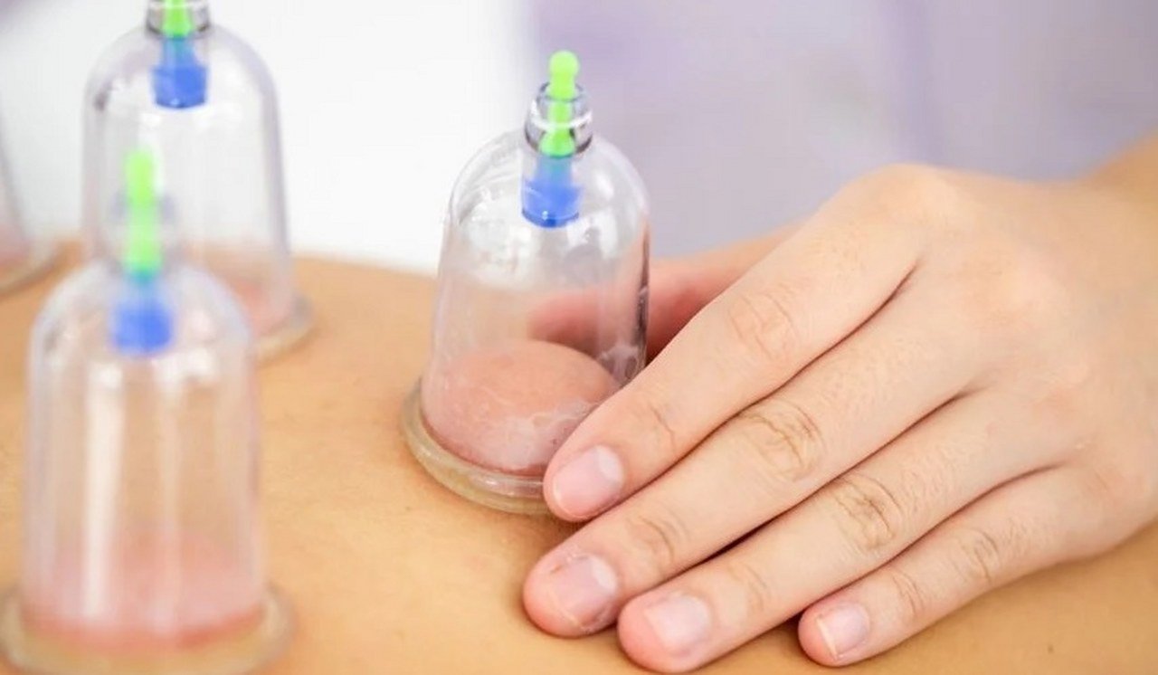 Hacamat Yaptirmamasi Gereken Ki̇şi̇ler 1280X746