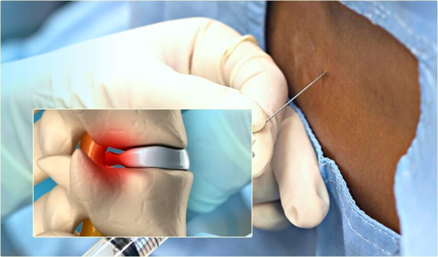 Brezilyalı Bilim İnsanlarından Devrim Niteliğinde Felç Tedavisi: “Polylaminin” ile Umut Doğdu