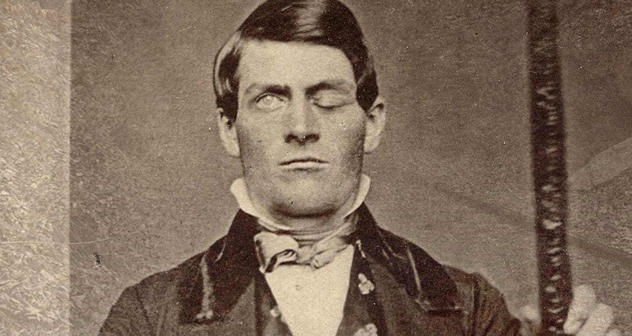 Phineas Gage